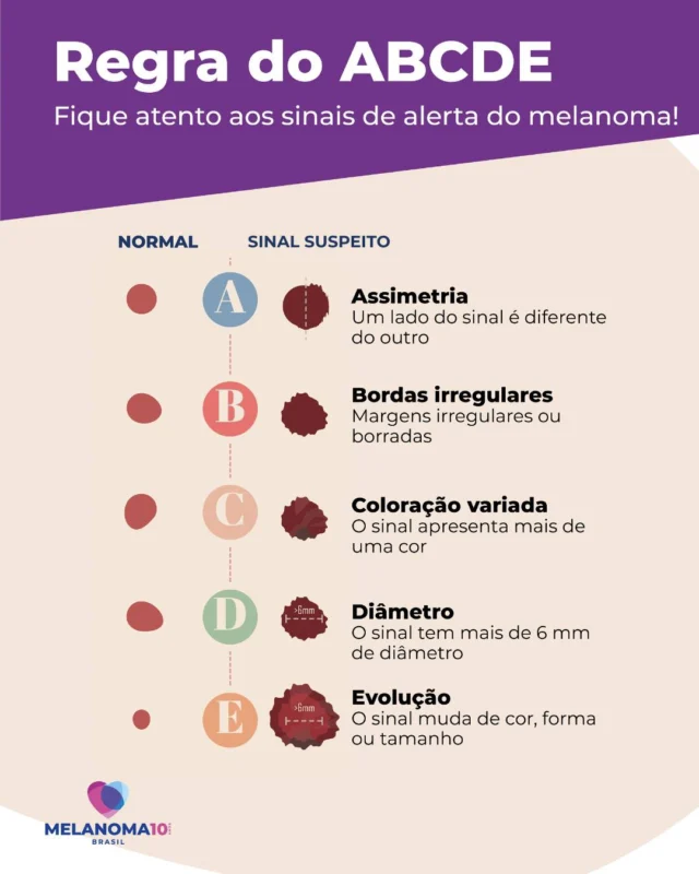 Você já ouviu falar em melanoma?

A maioria das pessoas ainda não. Quase 80% dos brasileiros não sabem que é o tipo mais agressivo de câncer de pele.

Mas e se a informação certa chegasse na hora certa? Você pode ser essa ponte! 

Conheça os sinais de alerta da doença e compartilhe essa informação com quem também precisa saber. 

O melanoma tem grande chance de cura se for descoberto e tratado em estágios iniciais. 

👁️ Fique de olho na sua pele e procure um dermatologista se encontrar qualquer anormalidade. A Regra do ABCDE não substitui avaliação medica!

#melanoma #melanomabrasil #regradoabcde #câncerdepele